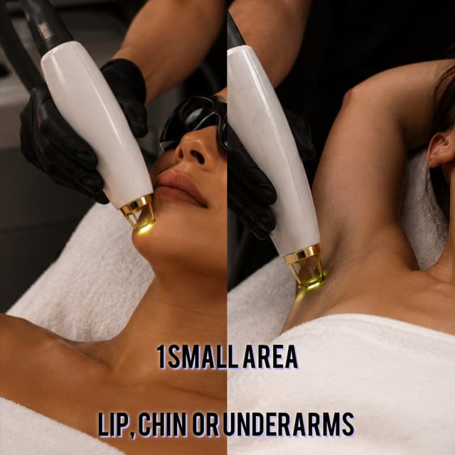 1 SMALL AREA LASER 8 sessions at Day 2 Skin LLC in Fort Oglethorpe, GA